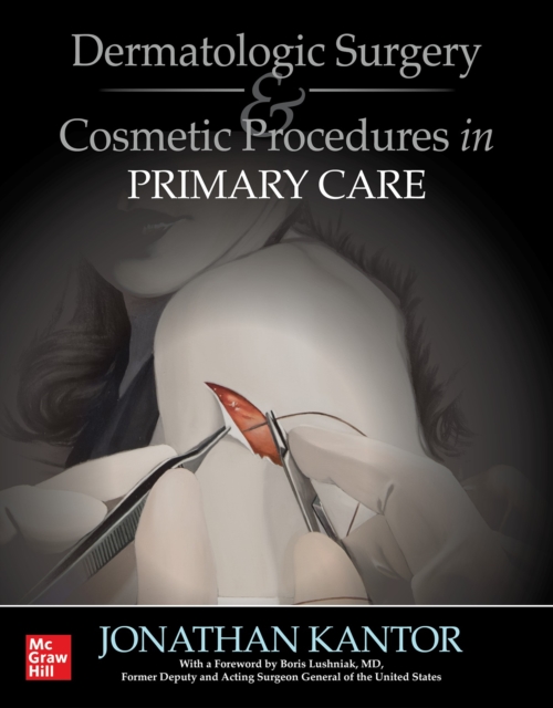 Dermatologic Surgery and Cosmetic Procedures in Primary Care Practice, EPUB eBook