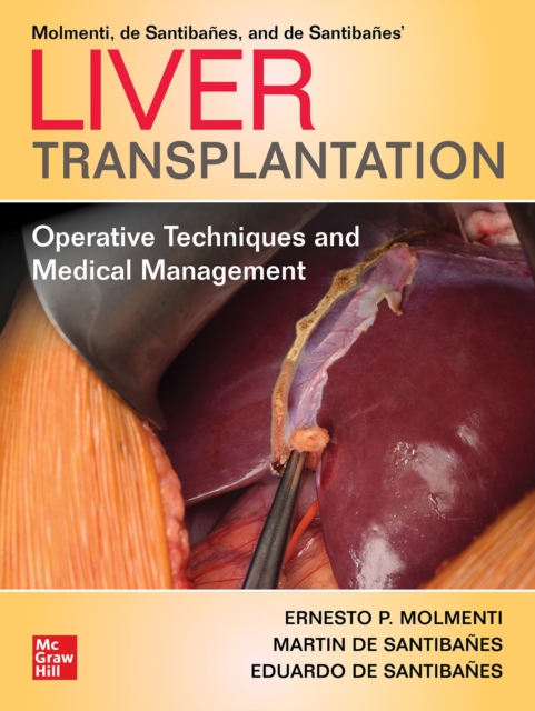 Liver Transplantation: Operative Techniques and Medical Management, EPUB eBook