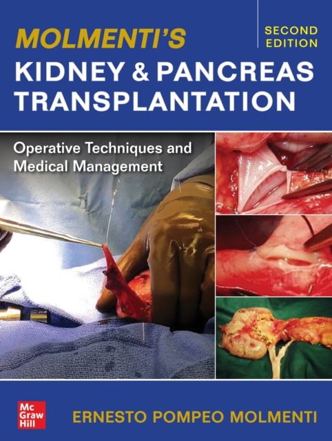 Molmenti's Kidney and Pancreas Transplantation: Operative Techniques and Medical Management, EPUB eBook