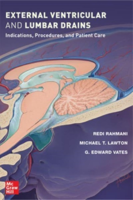 External Ventricular and Lumbar Drains: Indications, Procedures, and Patient Care, Paperback / softback Book