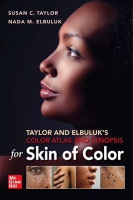 Taylor and Elbuluk's Color Atlas and Synopsis for Skin of Color, Paperback / softback Book