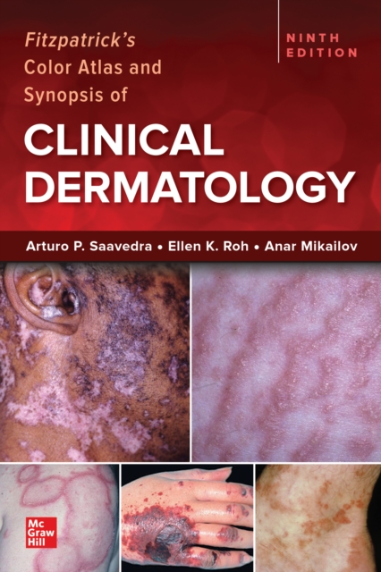 Fitzpatrick's Color Atlas and Synopsis of Clinical Dermatology, 9/e, EPUB eBook