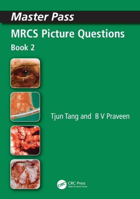 MRCS Picture Questions : A Practical Guide, v. 3, EPUB eBook