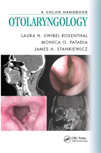 Otolaryngology : A Color Handbook, EPUB eBook