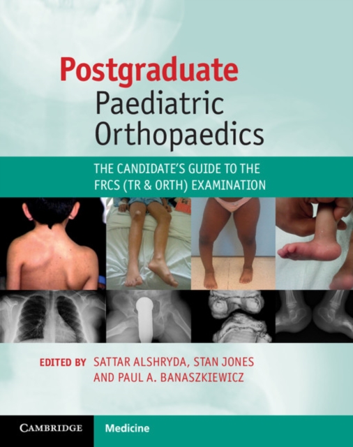 Postgraduate Paediatric Orthopaedics : The Candidate's Guide to the FRCS (Tr and Orth) Examination, PDF eBook