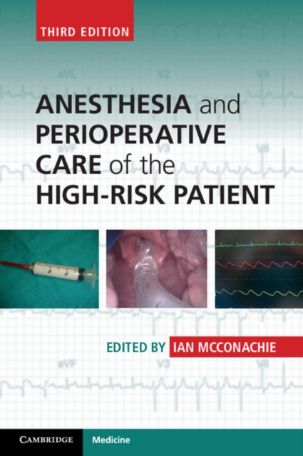 Anesthesia and Perioperative Care of the High-Risk Patient, PDF eBook