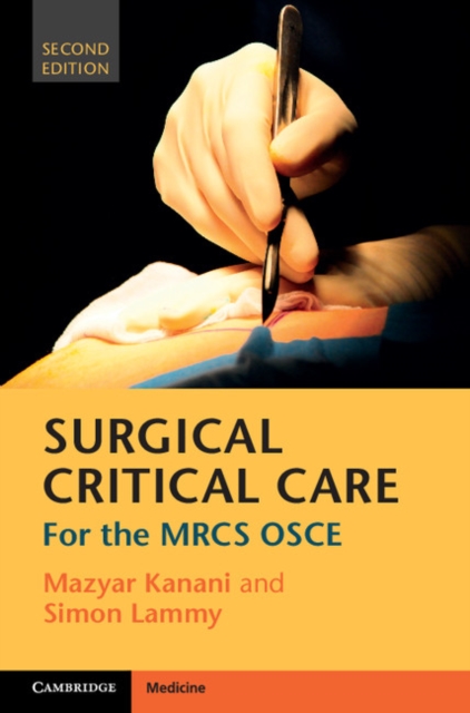 Surgical Critical Care : For the MRCS OSCE, PDF eBook