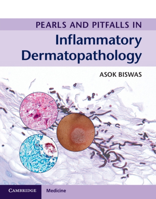 Pearls and Pitfalls in Inflammatory Dermatopathology, Multiple-component retail product Book