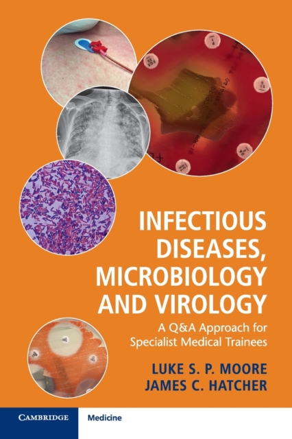 Infectious Diseases, Microbiology and Virology : A Q&A Approach for Specialist Medical Trainees, Paperback / softback Book