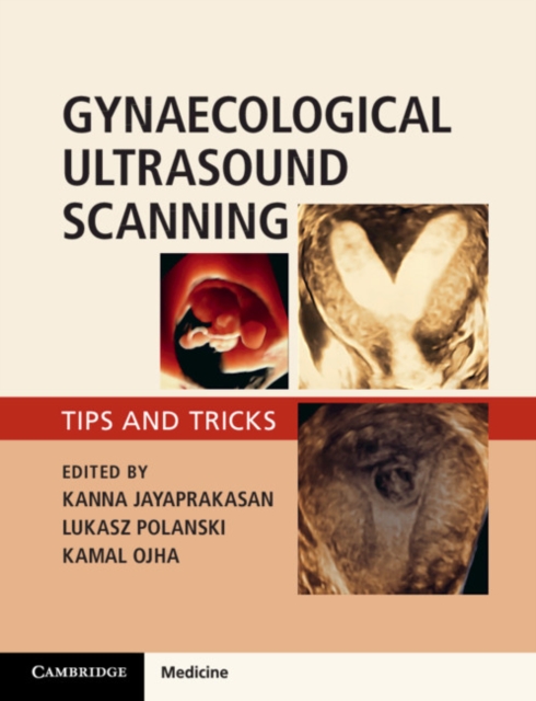 Gynaecological Ultrasound Scanning : Tips and Tricks, Paperback / softback Book