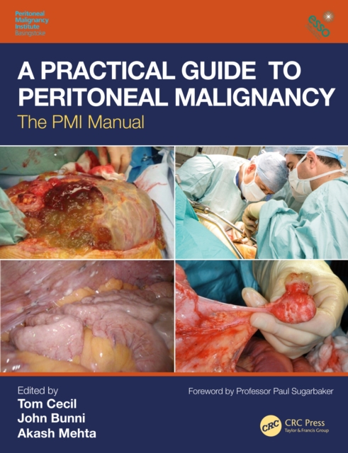 A Practical Guide to Peritoneal Malignancy : The PMI Manual, EPUB eBook