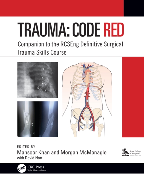 Trauma: Code Red : Companion to the RCSEng Definitive Surgical Trauma Skills Course, PDF eBook