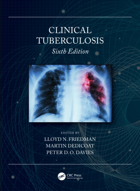 Clinical Tuberculosis, PDF eBook