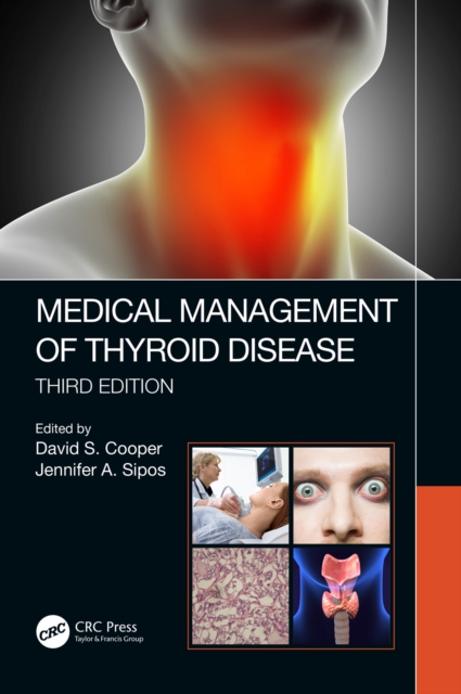 Medical Management of Thyroid Disease, Third Edition, PDF eBook