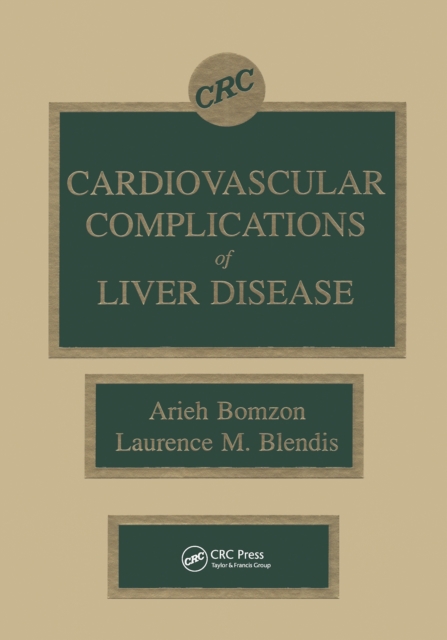 Cardiovascular Complications of Liver Disease, EPUB eBook