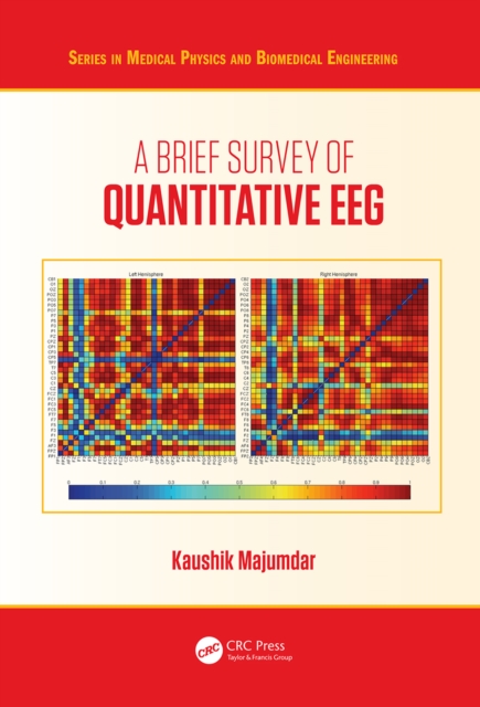 A Brief Survey of Quantitative EEG, EPUB eBook