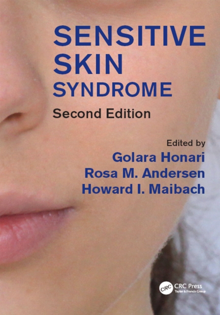 Sensitive Skin Syndrome, EPUB eBook