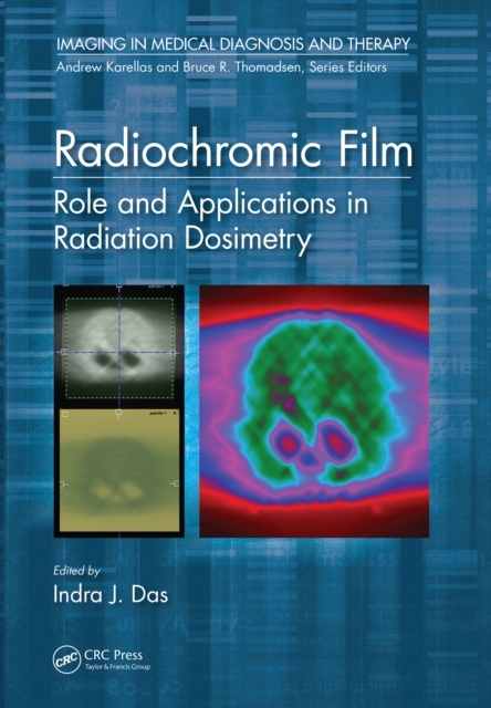 Radiochromic Film : Role and Applications in Radiation Dosimetry, EPUB eBook