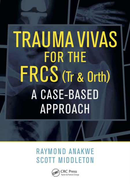 Trauma Vivas for the FRCS : A Case-Based Approach, PDF eBook
