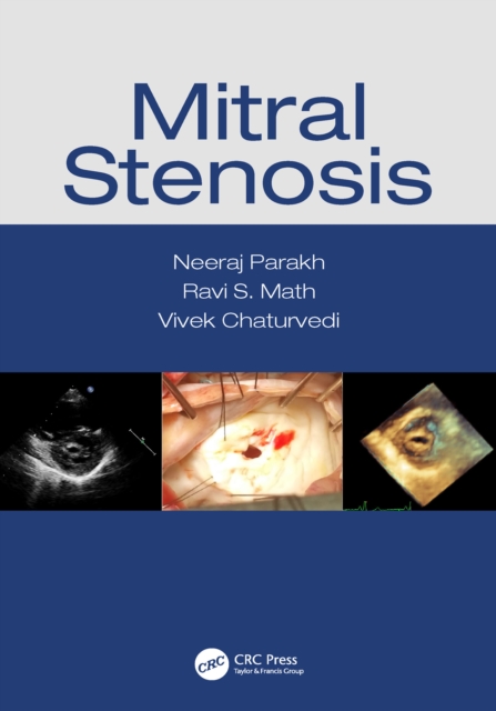 Mitral Stenosis, EPUB eBook