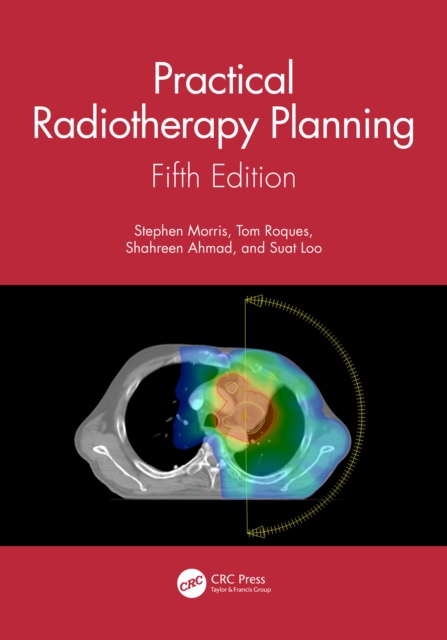 Practical Radiotherapy Planning : Fifth Edition, EPUB eBook