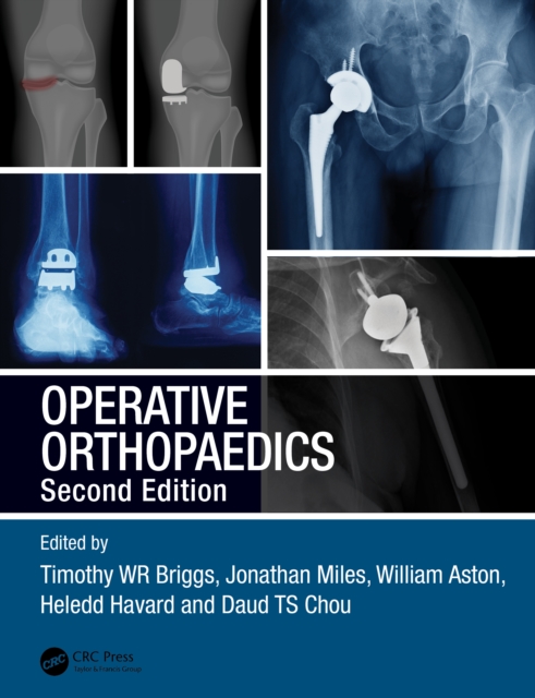 Operative Orthopaedics, EPUB eBook
