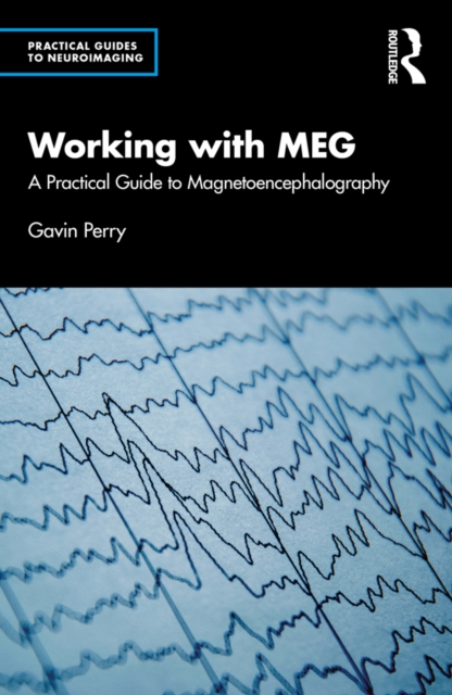 Working with MEG : A Practical Guide to Magnetoencephalography, EPUB eBook