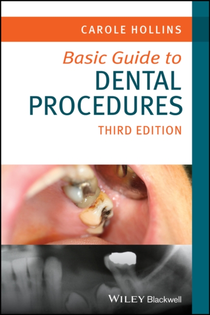 Basic Guide to Dental Procedures, PDF eBook