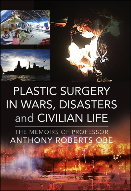 Plastic Surgery in Wars, Disasters and Civilian Life : The Memoirs of Professor Anthony Roberts OBE, EPUB eBook