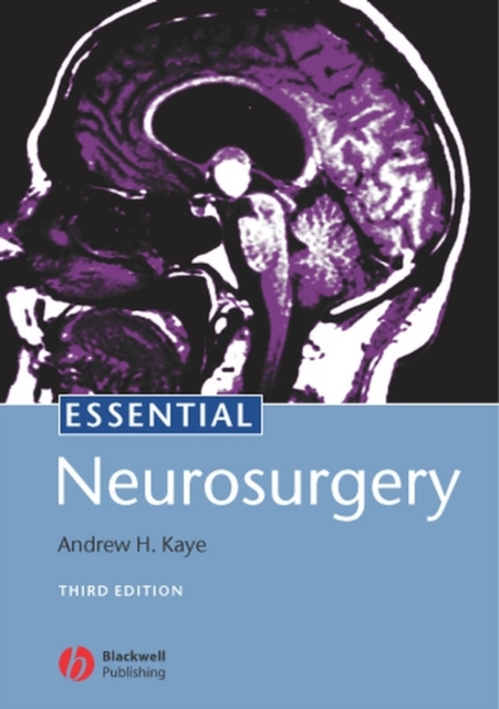 Essential Neurosurgery, Paperback / softback Book