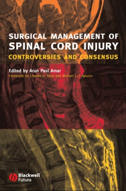 Surgical Management of Spinal Cord Injury : Controversies and Consensus, Hardback Book