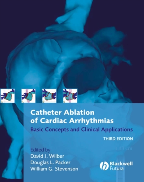 Catheter Ablation of Cardiac Arrhythmias : Basic Concepts and Clinical Applications, Hardback Book