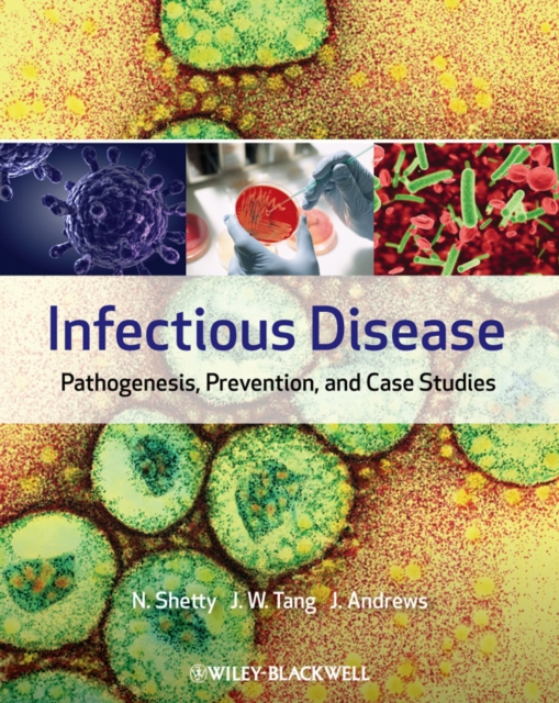 Infectious Disease : Pathogenesis, Prevention and Case Studies, Hardback Book