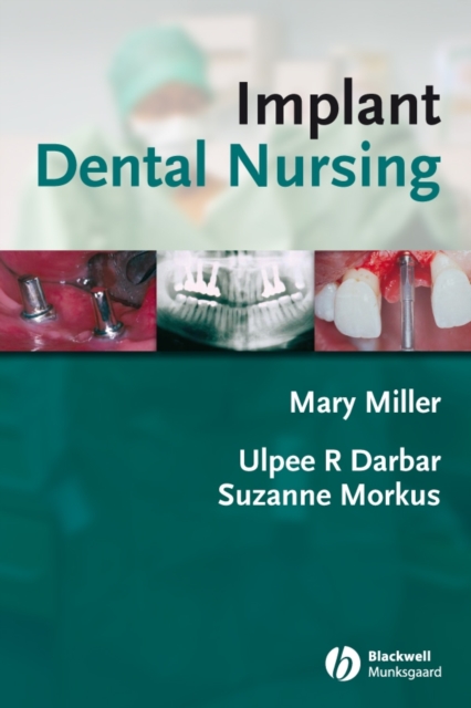 Implant Dental Nursing, Paperback / softback Book