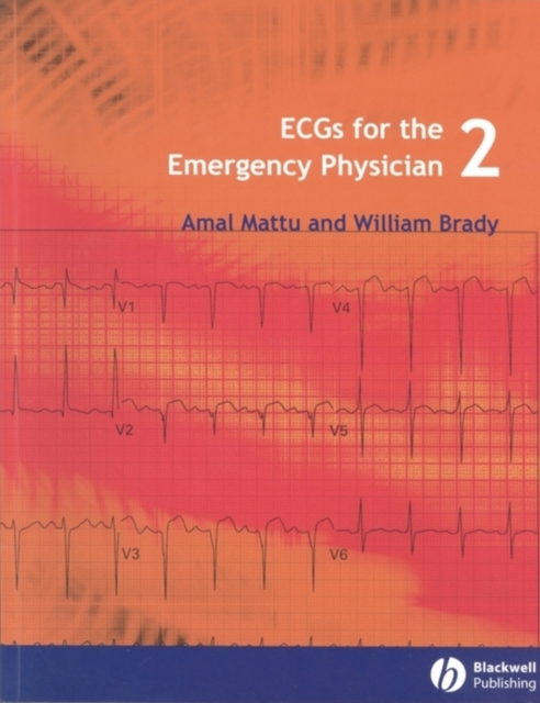 ECGs for the Emergency Physician 2, Paperback / softback Book