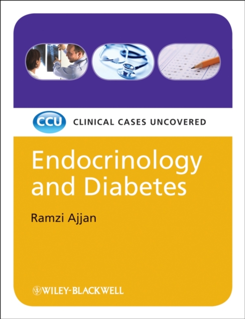 Endocrinology and Diabetes : Clinical Cases Uncovered, Paperback / softback Book