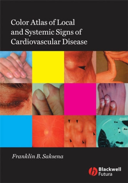 Color Atlas of Local and Systemic Manifestations of Cardiovascular Disease, Paperback / softback Book