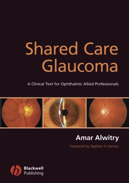 Shared Care Glaucoma, Paperback / softback Book