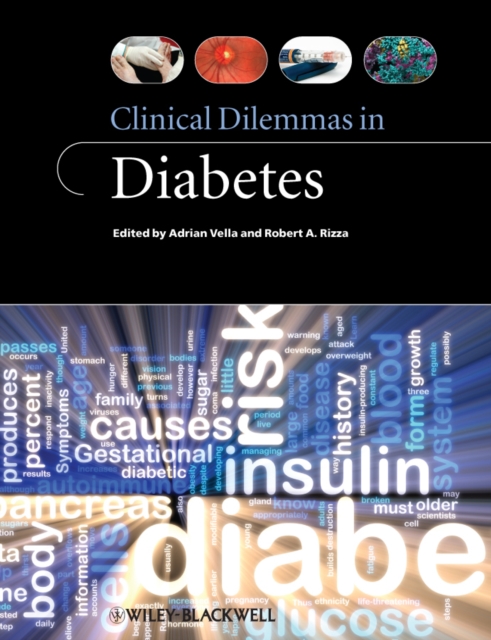 Clinical Dilemmas in Diabetes, Paperback / softback Book