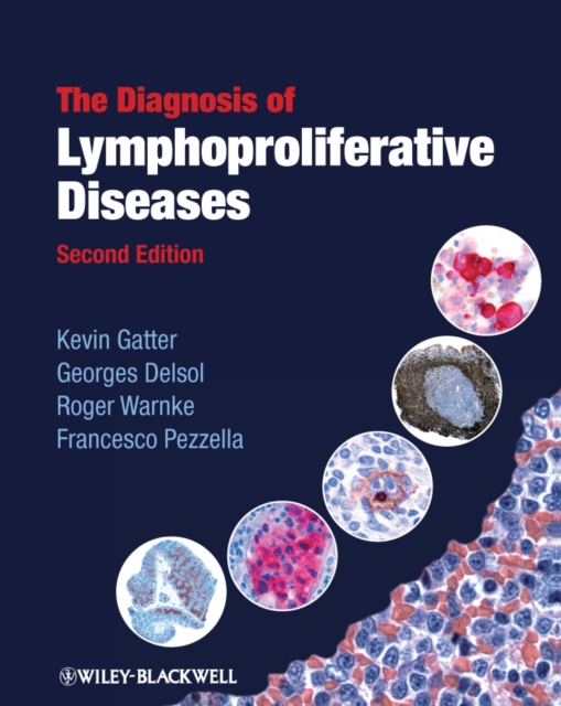 The Diagnosis of Lymphoproliferative Diseases, Hardback Book