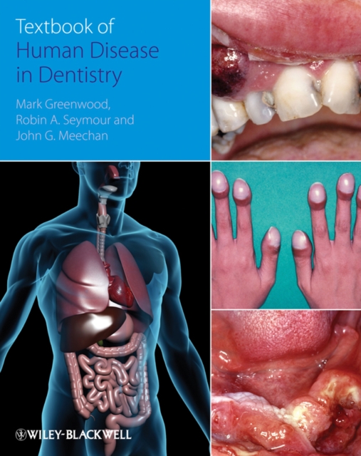 Textbook of Human Disease in Dentistry, Paperback Book