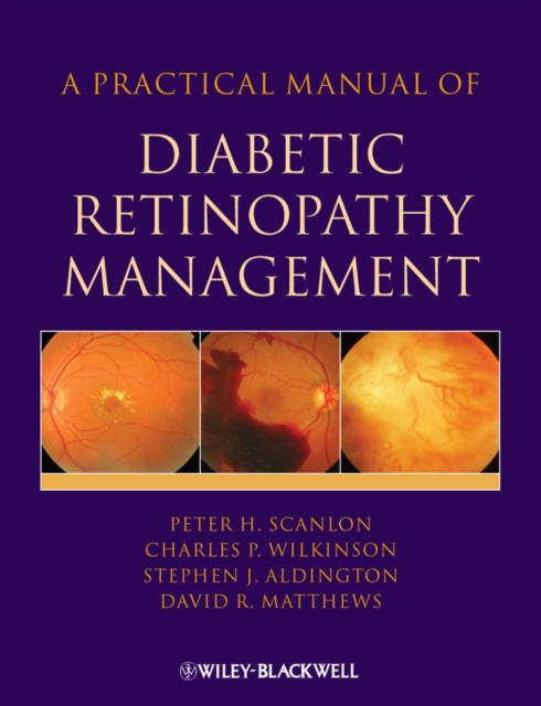 A Practical Manual of Diabetic Retinopathy Management, Hardback Book