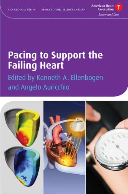 Pacing to Support the Failing Heart, Hardback Book