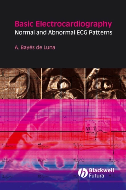 Basic Electrocardiography : Normal and Abnormal ECG Patterns, Paperback / softback Book