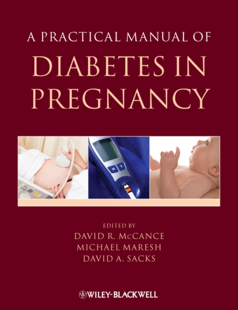 A Practical Manual of Diabetes in Pregnancy, Hardback Book