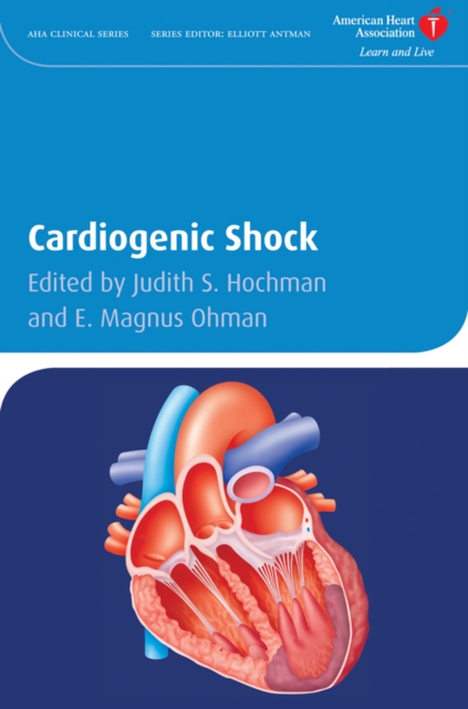 Cardiogenic Shock, Hardback Book