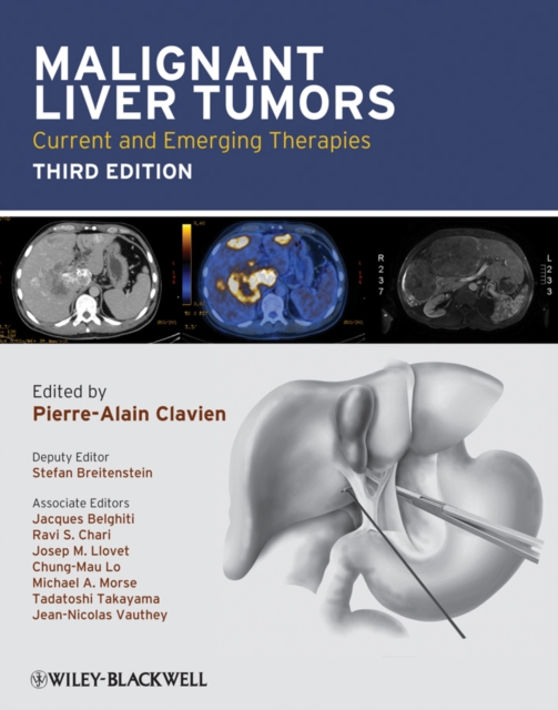 Malignant Liver Tumors : Current and Emerging Therapies, Hardback Book