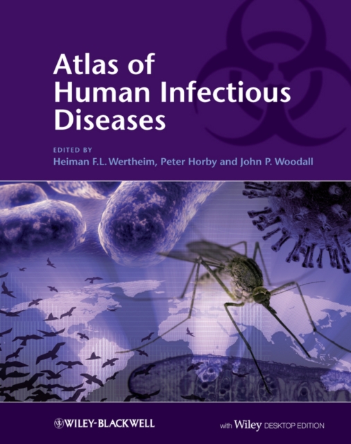 Atlas of Human Infectious Diseases : Includes Desktop Edition, Hardback Book