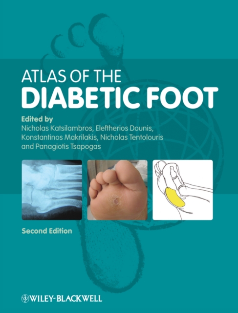 Atlas of the Diabetic Foot, Hardback Book