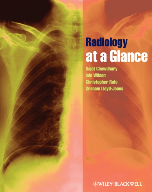 Radiology at a Glance, Paperback Book